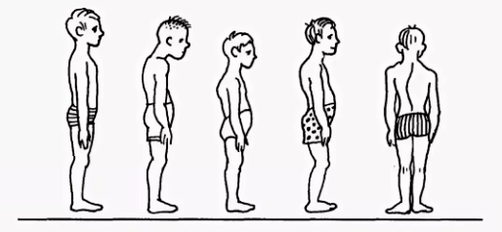 Naruszenie postawy