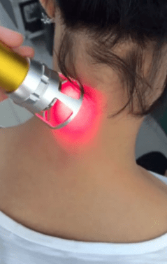 Terapia laserowa