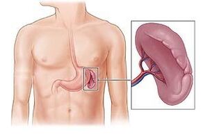 patologia śledziony jako przyczyna bólu pod lewą łopatką