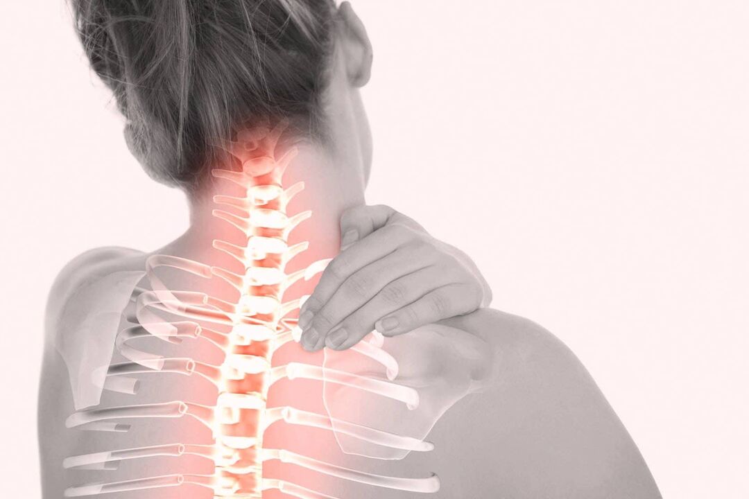 ból kręgosłupa szyjnego z powodu osteochondrozy