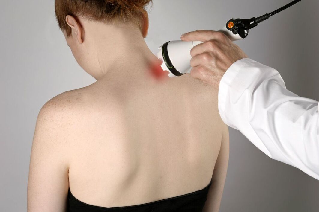 fizjoterapeutyczne leczenie osteochondrozy szyjnej